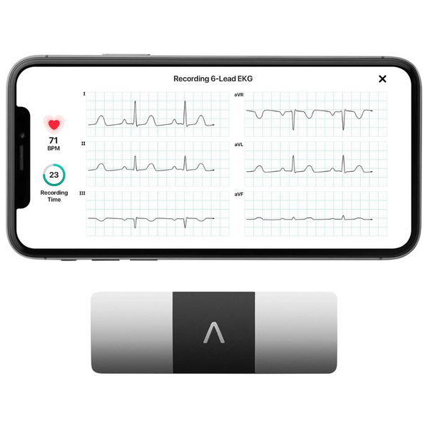 AliveCor KardiaMobile 6-Lead Personal EKG Monitor